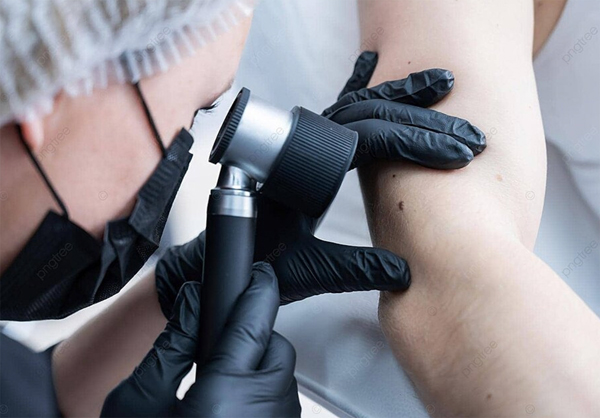 examining mole